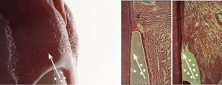 La enfermedad periodontal