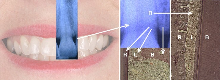 La enfermedad periodontal
